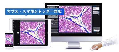顕微鏡撮影にスマホ・マウスシャッター可能